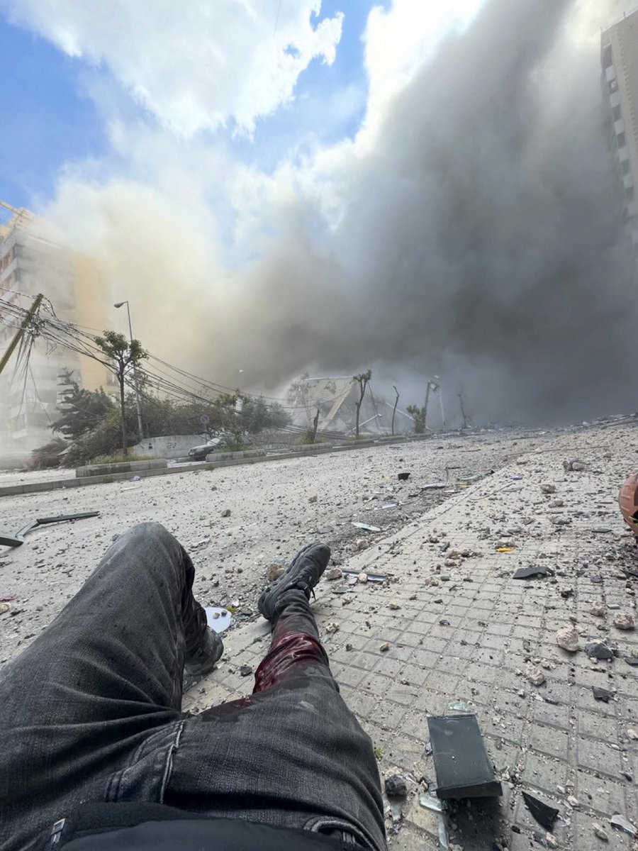 MyLordBebo's tweet photo. 🇮🇱🇱🇧 Haytham Al-Moussawi, the chief photographer for Al-Akhbar newspaper, covered the Israeli attack in Beirut extremely closely.

He’s injured but … took this photo yesterday. https://t.co/ee4kljKeEo