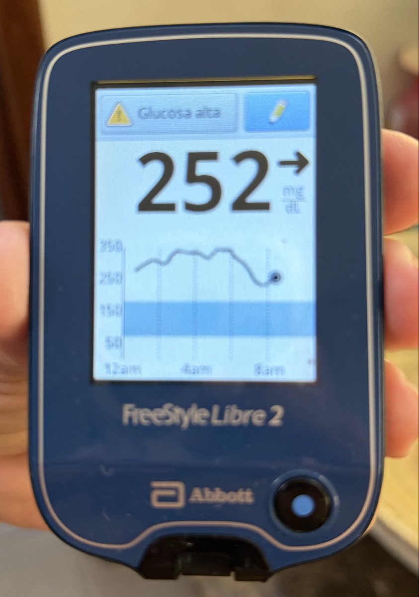 PabloFP's tweet photo. Buen día @MinSalud_Ar @ANMATsalud 
Como es posible que que @FreeStyleDiabet @AbbottNews siga comercializado @FreeStyleLibre sin resolver los problemas de software? En la captura que adjunto hay 3 mediciones de glucosa realizadas solo con 1 minuto de diferencia y los valores difieren en 150 mg/dl. Una locura. Los sensores no entregan información confiable y el riesgo de una hipoglucemia es altísimo, con lo que eso implica. @BettinaMVogel