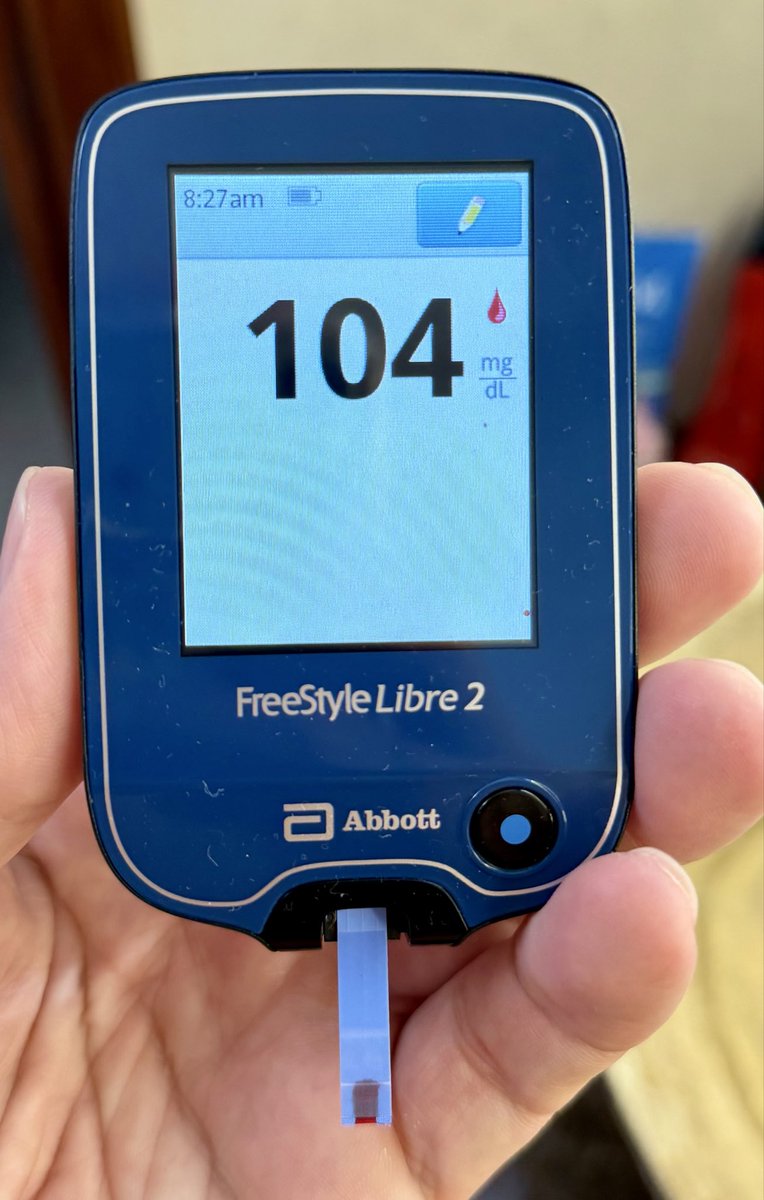 PabloFP's tweet photo. Buen día @MinSalud_Ar @ANMATsalud 
Como es posible que que @FreeStyleDiabet @AbbottNews siga comercializado @FreeStyleLibre sin resolver los problemas de software? En la captura que adjunto hay 3 mediciones de glucosa realizadas solo con 1 minuto de diferencia y los valores difieren en 150 mg/dl. Una locura. Los sensores no entregan información confiable y el riesgo de una hipoglucemia es altísimo, con lo que eso implica. @BettinaMVogel