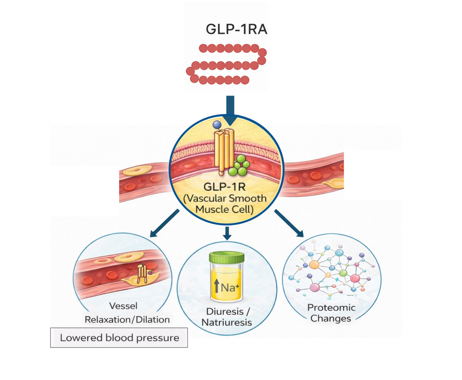 DanielJDrucker's tweet image. No doubt #weightloss also provides a range of additional benefits to many of the comorbidities successfully targeted by GLP-1 medicines. Yet for some conditions (not all) weight loss-independent mechanisms also contribute #hypertension insight.jci.org/articles/view/…