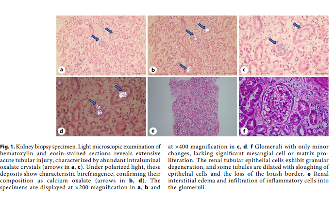 Nephrology | Karger tweet media