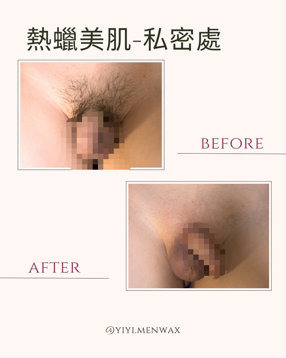 ㄧㄧ tweet media