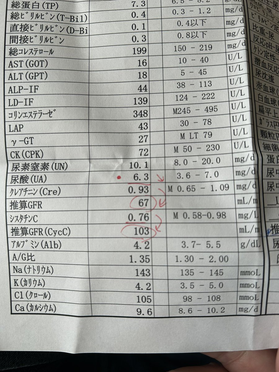 masakin3811's tweet photo. 久しぶりに血を抜くのがヘタな人にあたってめっちゃ内出血してる😭

尿酸値少し下がった🤣 https://t.co/8txExeO6j7