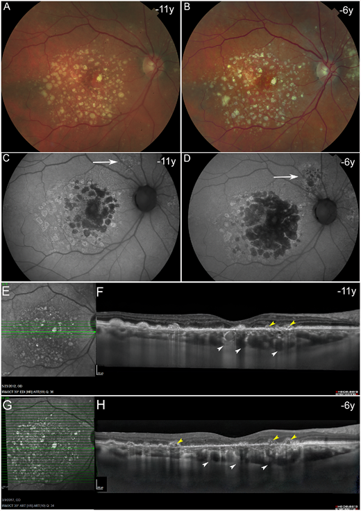 IOVS Journal tweet media