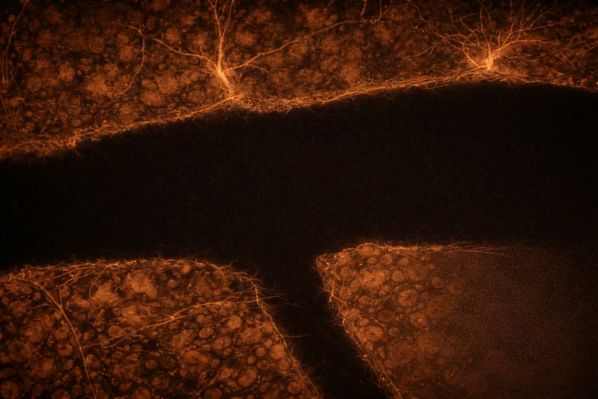 europawire's tweet image. EQT Foundation Opens International Funding Call to Accelerate Deeptech Solutions for Brain Drug Delivery news.europawire.eu/eqt-foundation…

@eqtfoundation #technologies #blood_brain_barrier #innovations #investment #alzheimers_disease #parkinsons_disease #ALS #braintumors #financial