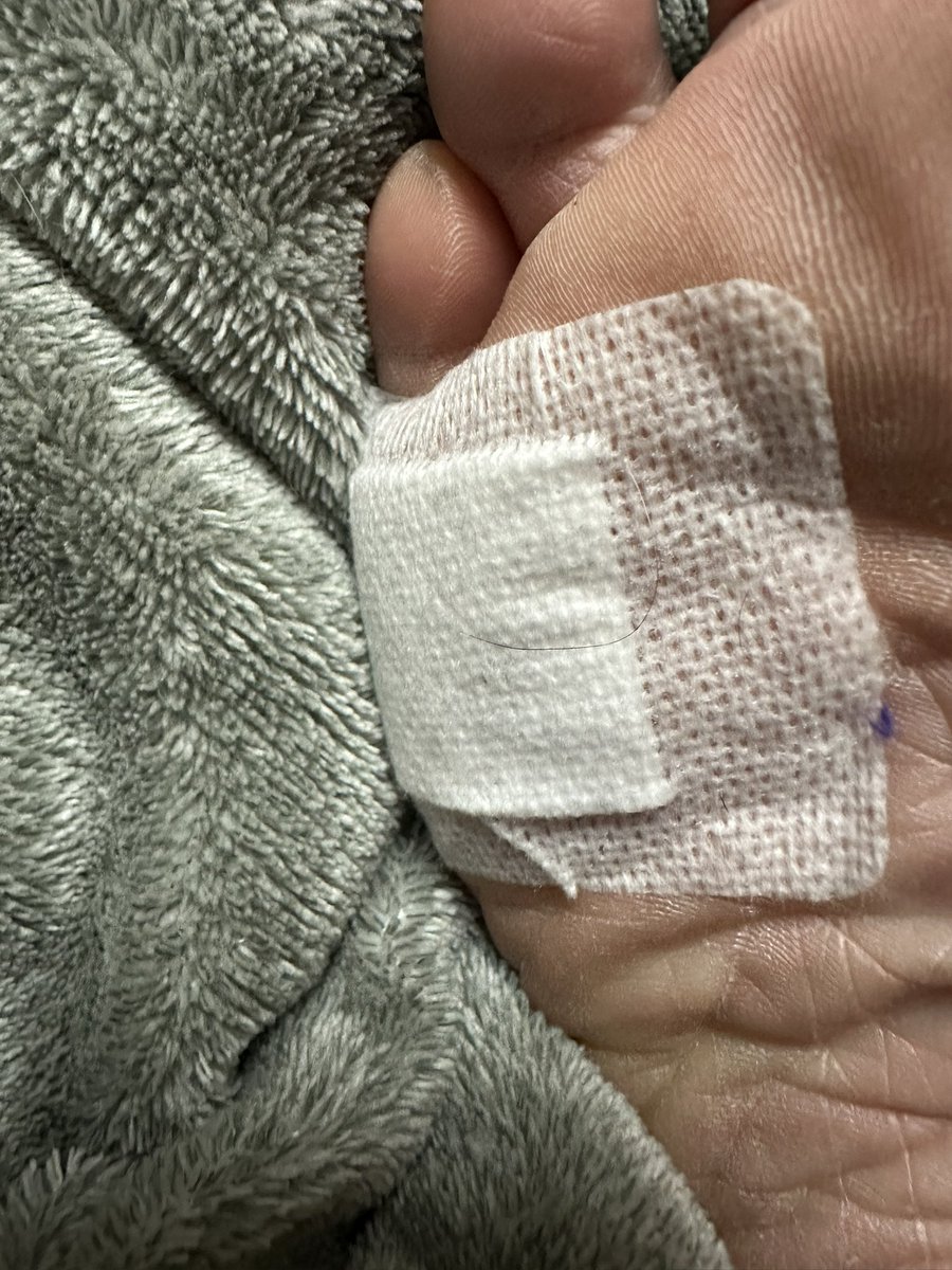 釘踏んで足裏負傷…

こないだガラス刺さった横…

今年ケガ多くなるな☺
保険入っててよかったー