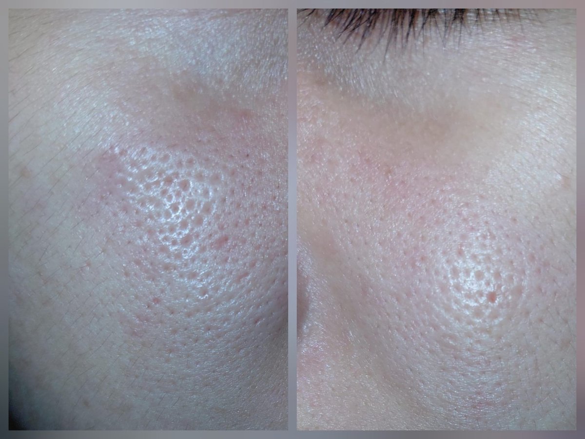 ✨OMBB | 🚫NO LINK tweet media