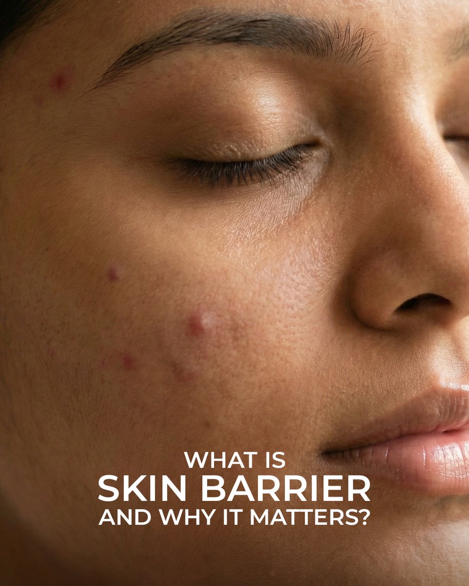 AcnestarGel's tweet image. A compromised skin barrier needs time and the right ingredients to heal. 
AcneStar Gel provides that healing potential with a science-backed formula designed for daily use.

#acnestar #acnestarskincare #acnecare #antiacne #acnetreatment #clearskinroutine #healthyskindaily