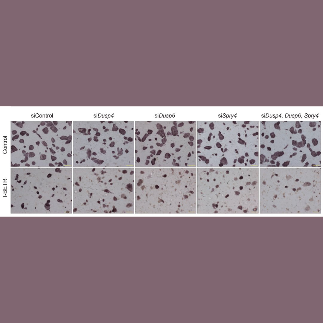 Genes & Development tweet media