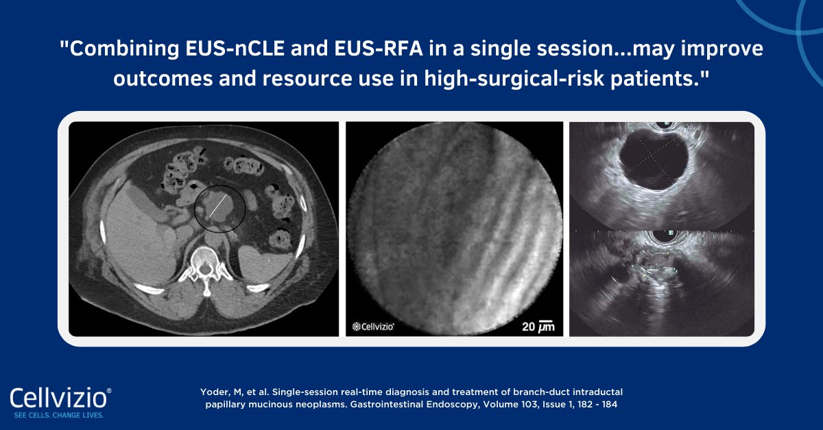 Cellvizio® by Mauna Kea Technologies tweet media