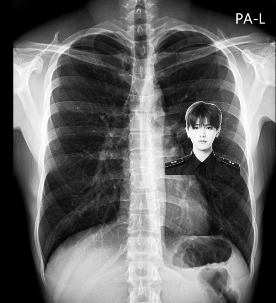 후잉 tweet media