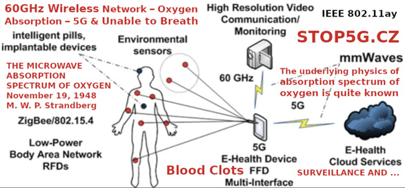 JimmyG4Me's tweet image. WE DO NOT NOR DID WE CONSENT TO BEING RADIATED FOR FASTER SERVICE IN THE ETHERS. GTFOH WITH THIS CRAP. WOW JUST WOW. DO UR RESEARCH BEFORE PROMOTING THINGS THAT KILL  HUMANS. WTF. #GLORY2JESUS WRATH IS COMING. SURE HATE TO BE IN THEM TRANSHUMANIST SHOES. TICK TOCK. #JAMES55 BET