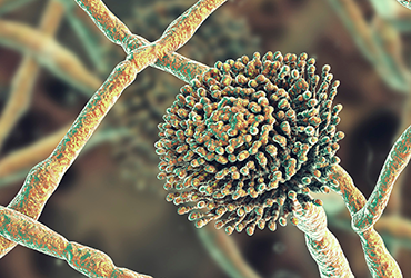 PharmPracNews's tweet image. New retrospective analysis examines epidemiology, diagnosis &amp;amp; outcomes of Aspergillus osteomyelitis across two U.S. centers.
▶️ Full story: pharmacypracticenews.com/a/6TUBAA/t  #Antifungal #ClinicalResearch