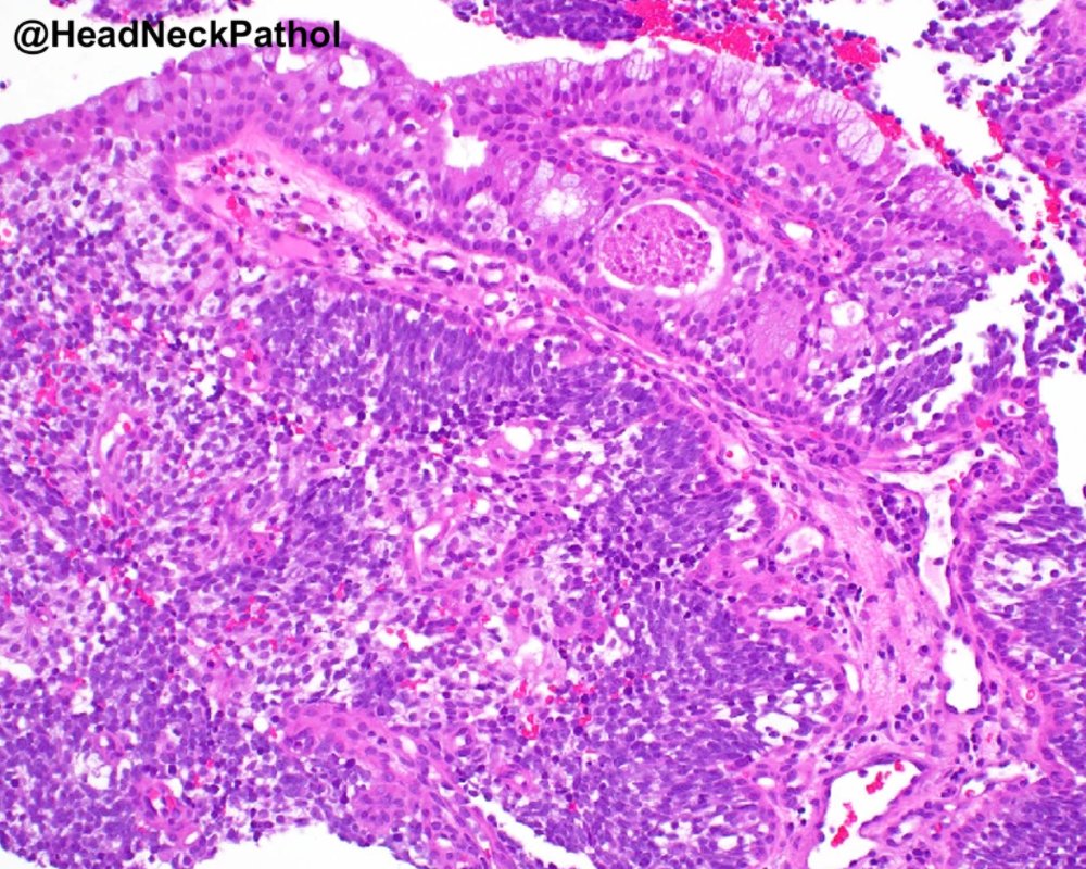 Head Neck Pathol tweet media