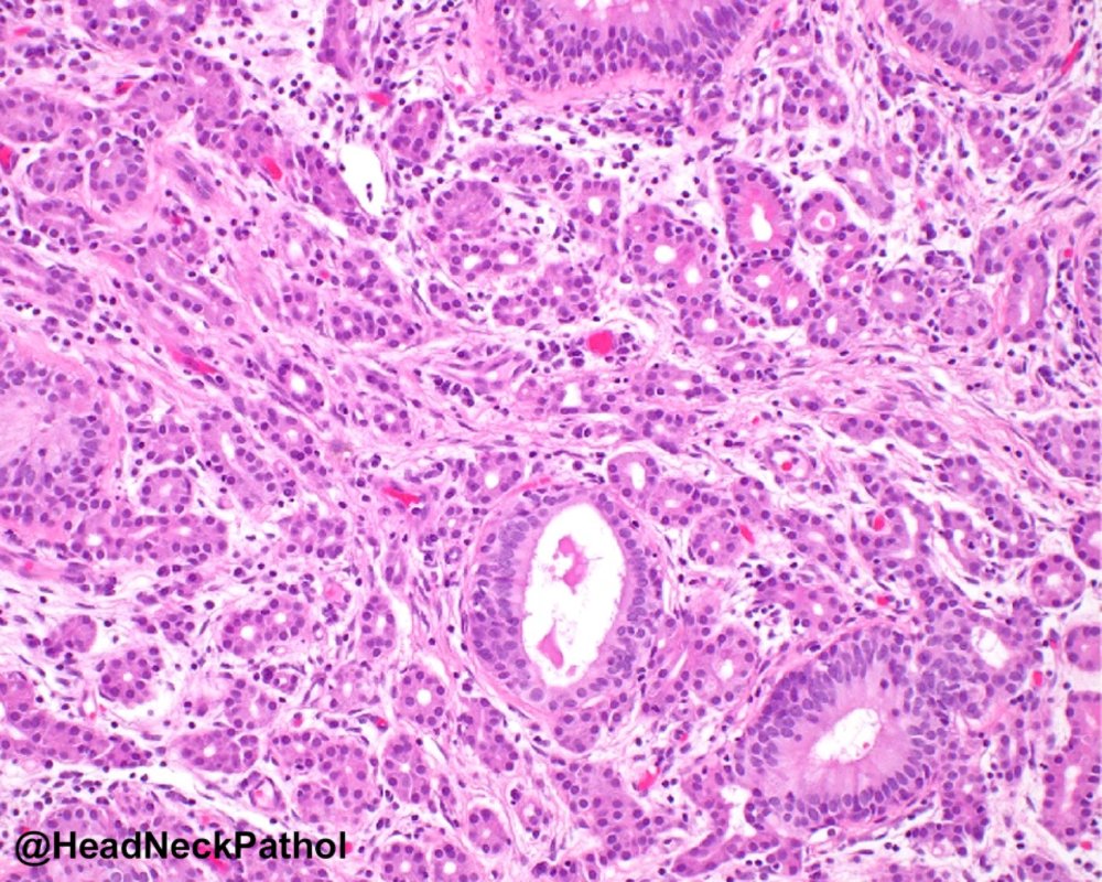 Head Neck Pathol tweet media