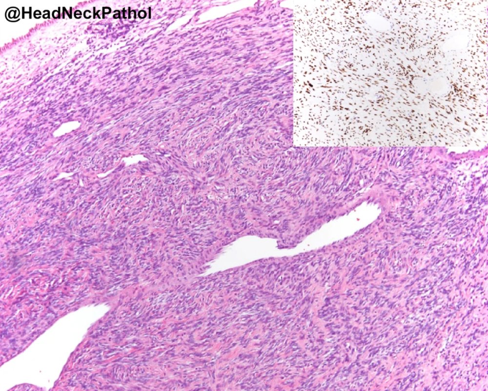 Lester Thompson tweet media