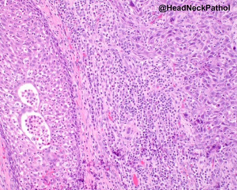 Lester Thompson tweet media