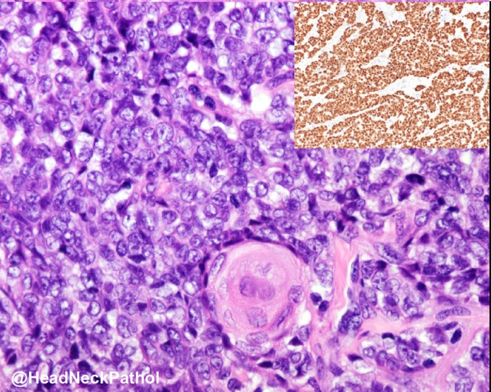 Lester Thompson tweet media