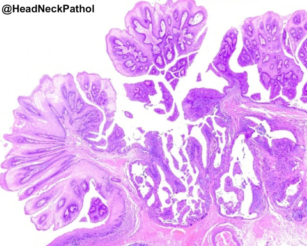 Head Neck Pathol tweet media