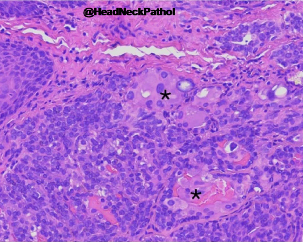 Head Neck Pathol tweet media