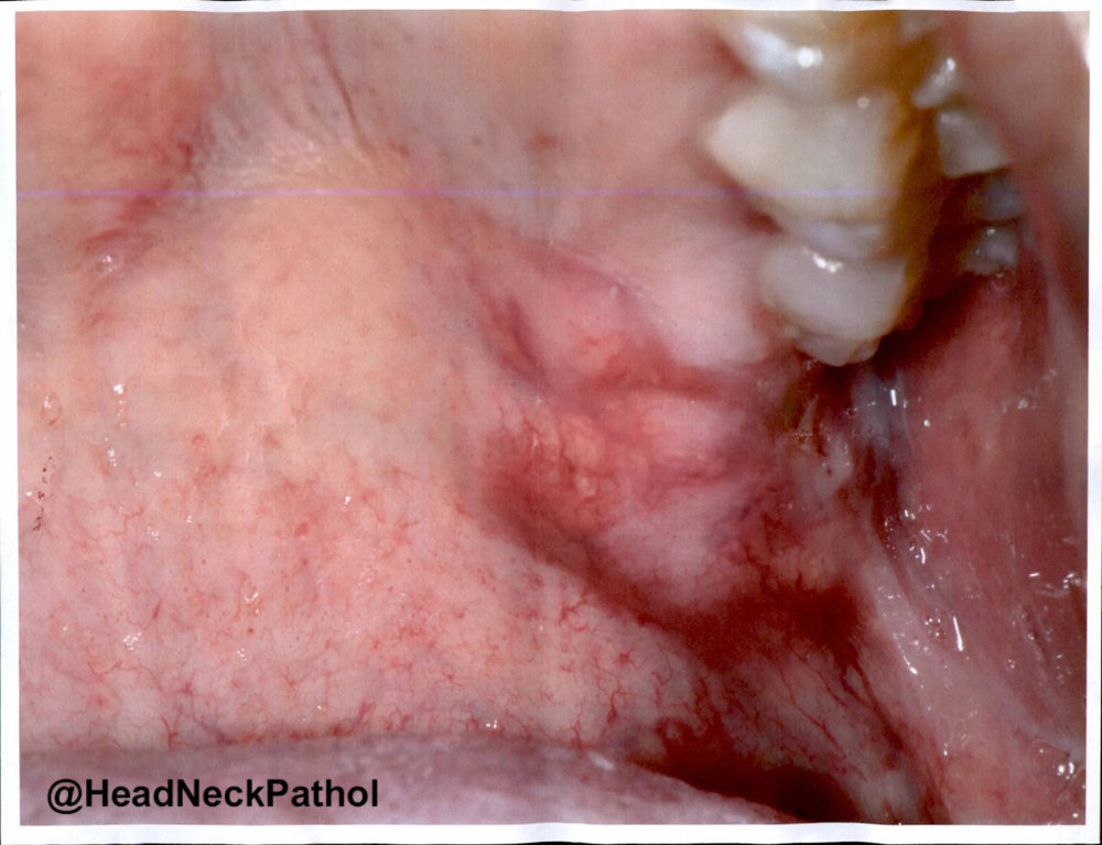 Head Neck Pathol tweet media