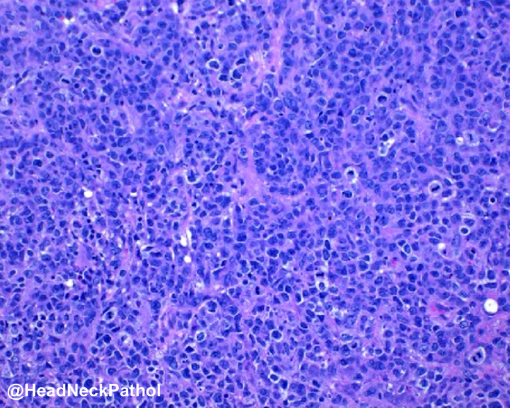 Lester Thompson tweet media