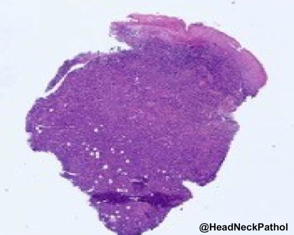 Lester Thompson tweet media