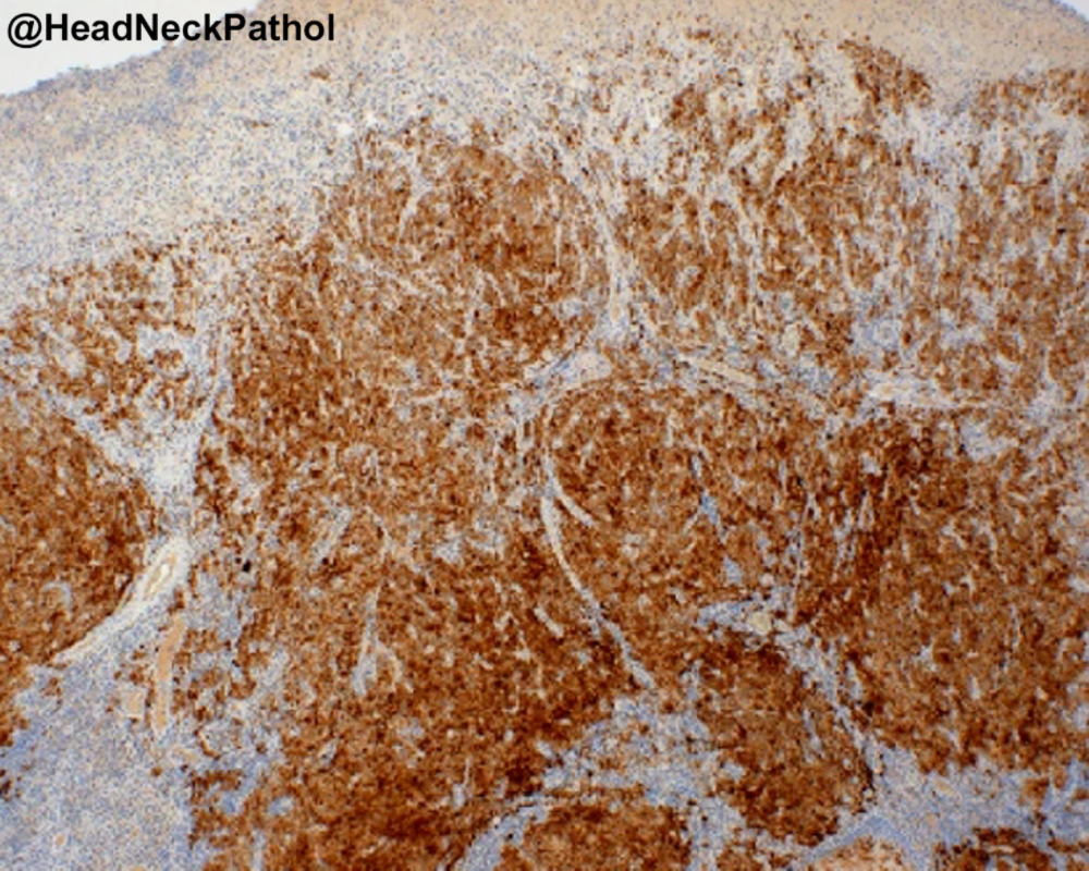 Head Neck Pathol tweet media