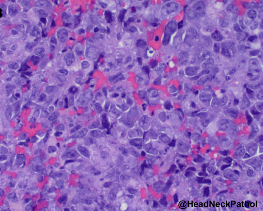 Head Neck Pathol tweet media