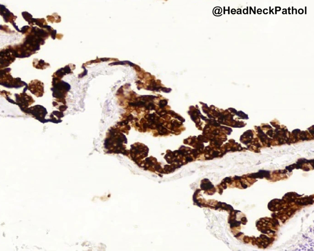 Lester Thompson tweet media