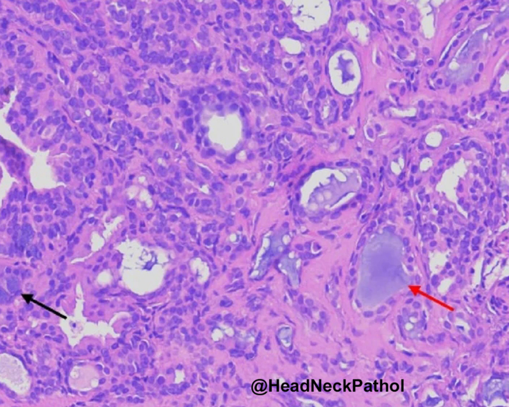 Lester Thompson tweet media