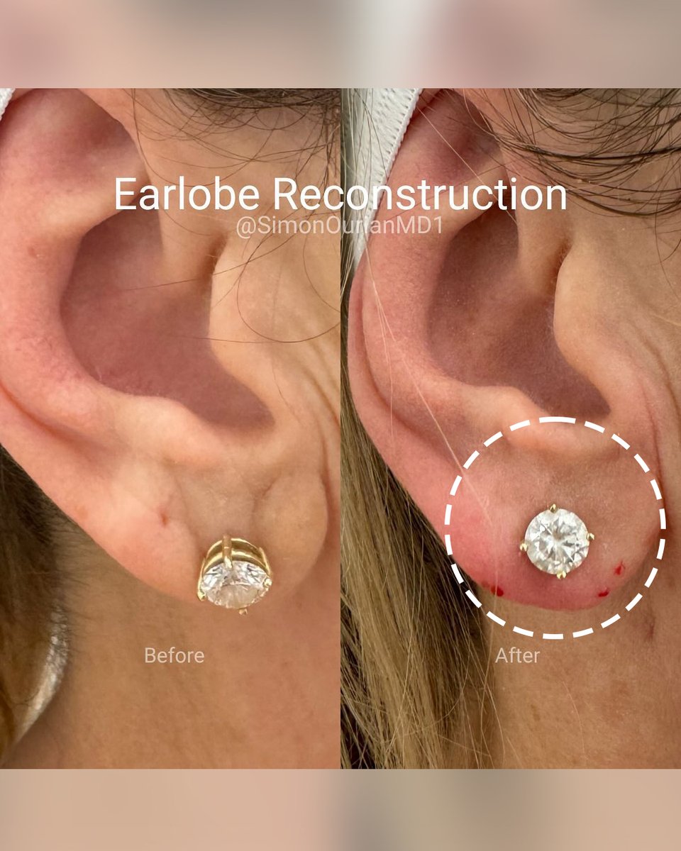 Dr. Simon Ourian - Epione tweet media