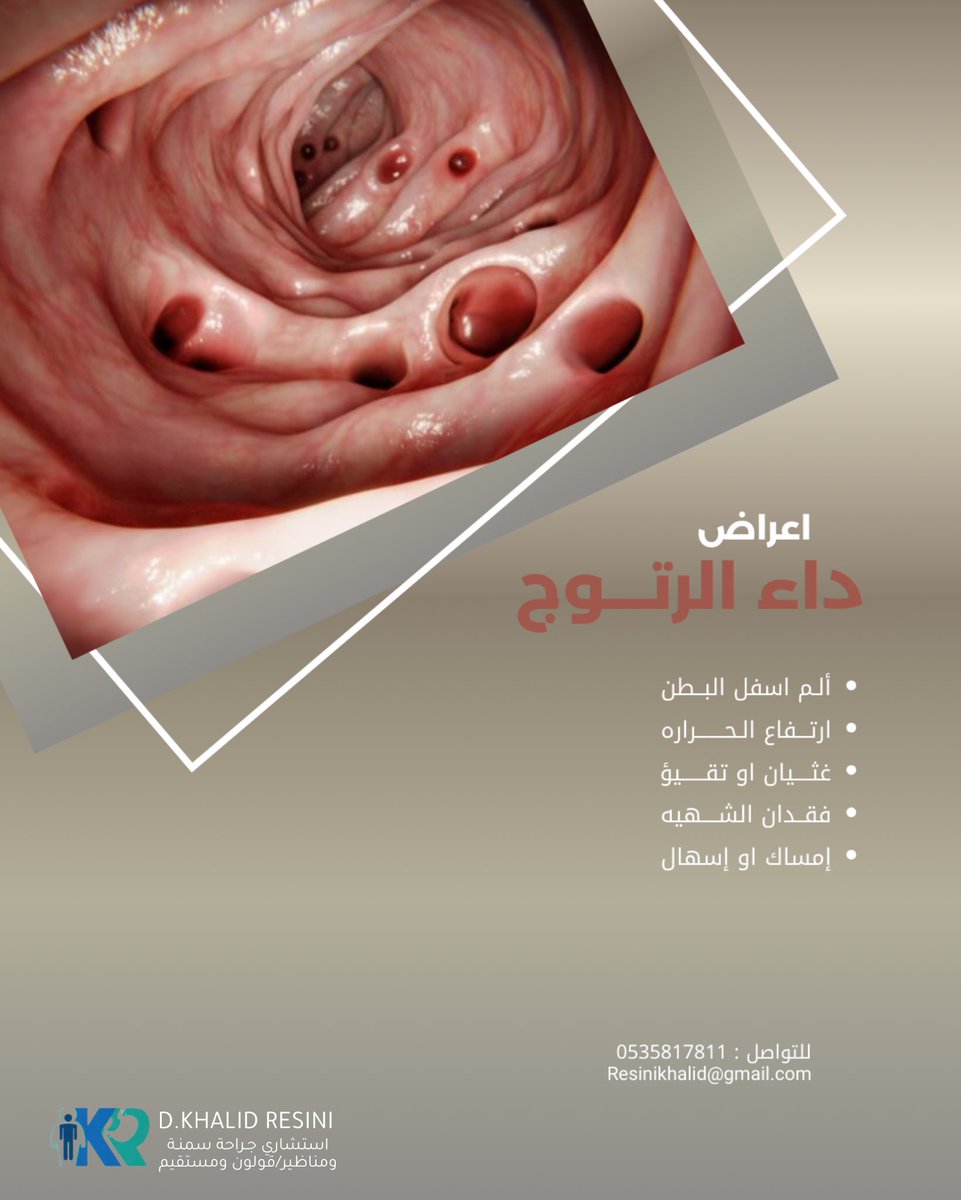 د.خالد الرسيني tweet media