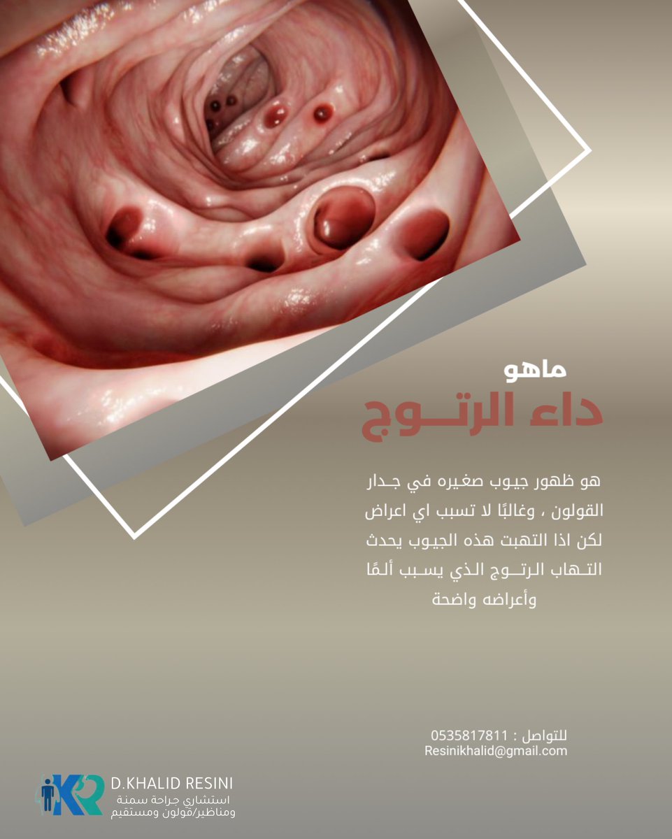د.خالد الرسيني tweet media