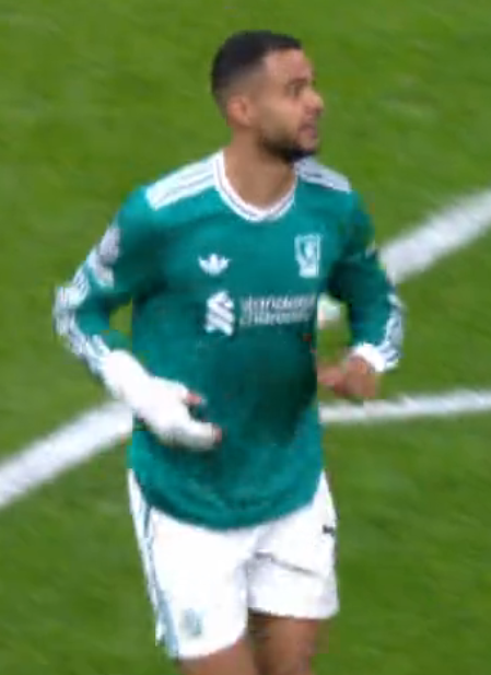 Cody Gakpo's right hand is injured from Jerking Arne Slot's Tiny Twig

#UCL #GSLIV