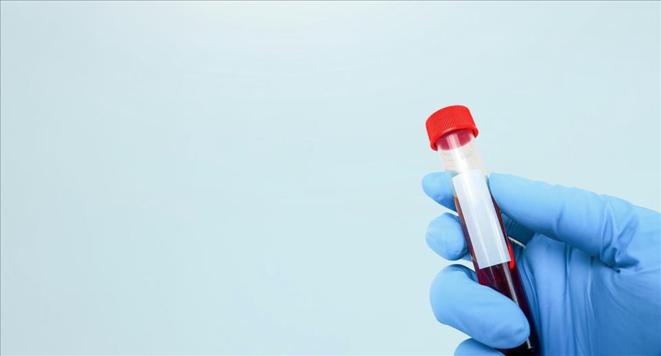MENAFN's tweet image. Blood Tests For Cancer? We're Still A Way Off #Blood #Tests #Cancer? #We're #Still #USA #Russia #Biden #Ukraine #War #Palestine #Gaza #Israel # dlvr.it/TRQ2hv