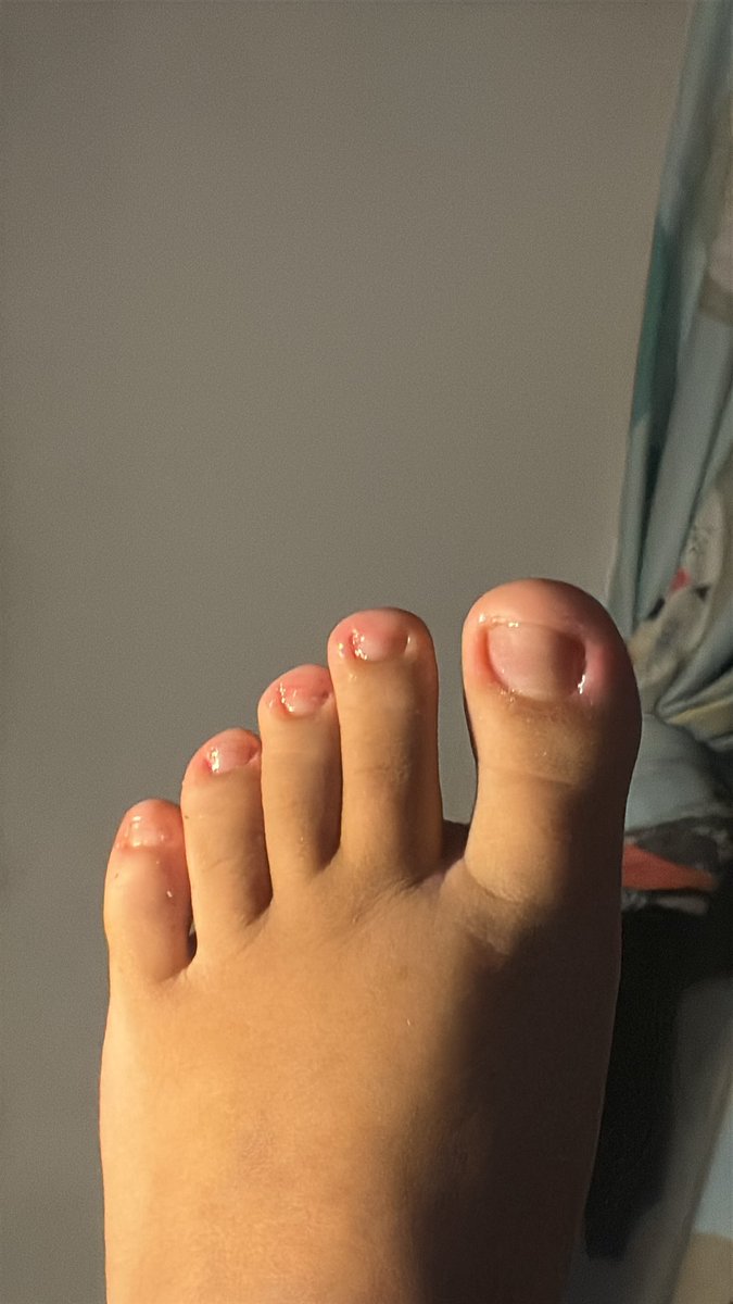 mpacksfeet's tweet photo. 👣💅🤭 VENDAS ON  PACKZIN DO PÉ E DA MÃO NO PREÇO, SO CHAMAR NA DM (Pagamento adiantado com prévia) https://t.co/6ZtHofBwJk