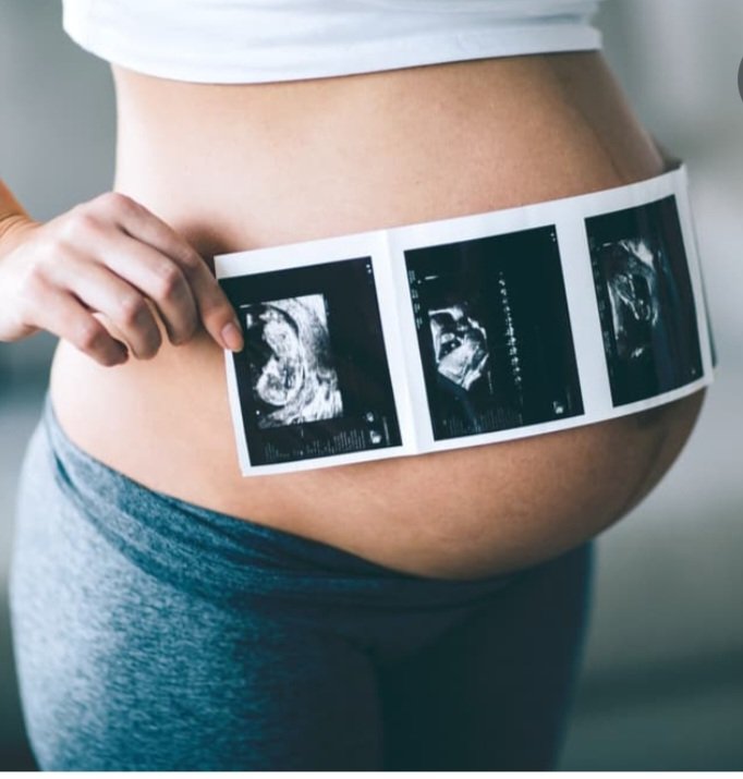 NO ES TU CUERPO. ESTÁ EN TU CUERPO Y TIENE DERECHO A VIVIR  #DejaloNacer
#PorLaVidaSiempre