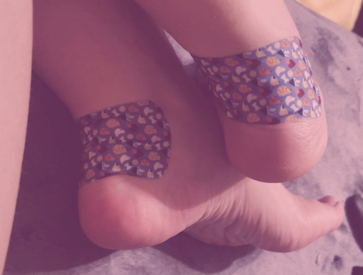 Chainedbylxve's tweet photo. Hurt my feet’s walking…my doc martins were rubbing behind my ankles and created another blister formation…this happens to me a lot to the point where I get so many and when it heals it creates a brown tan circle spot on both..💔 #feet #puppyboy #tboy #poorme https://t.co/wbvi7Y4ifo