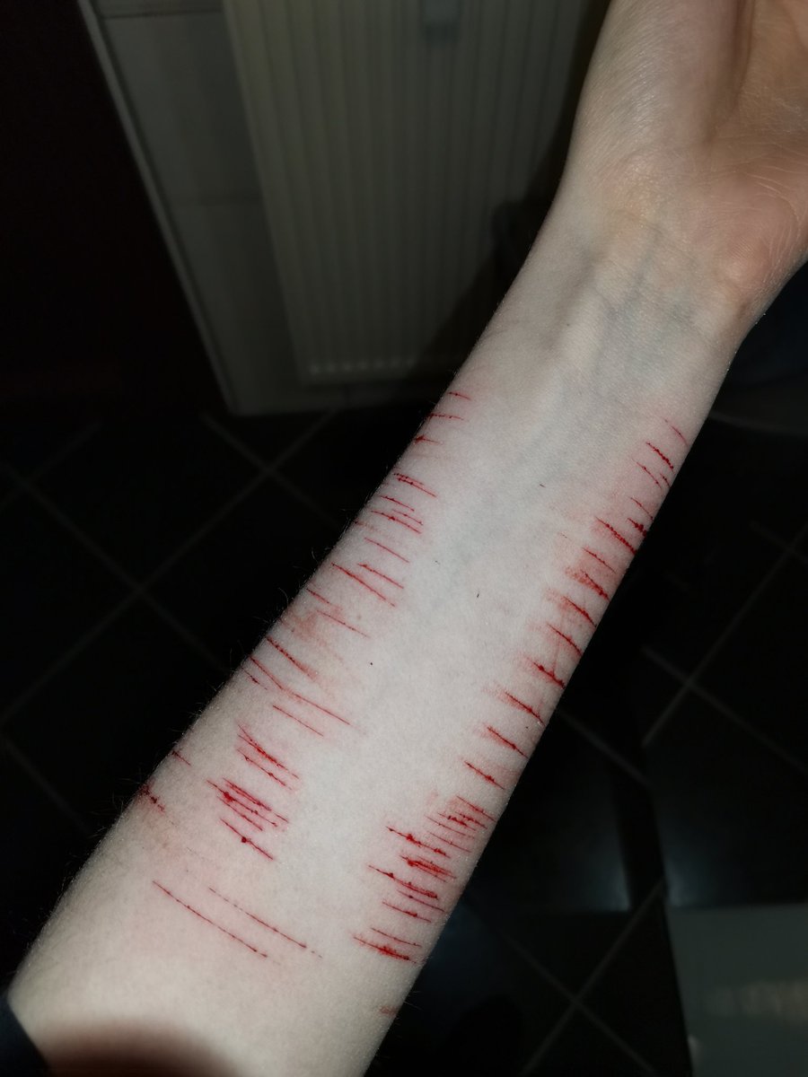 ZeraEmpero's tweet photo. Ouch ig....?
#shtwt #selfharm https://t.co/zWsL5jTZyt