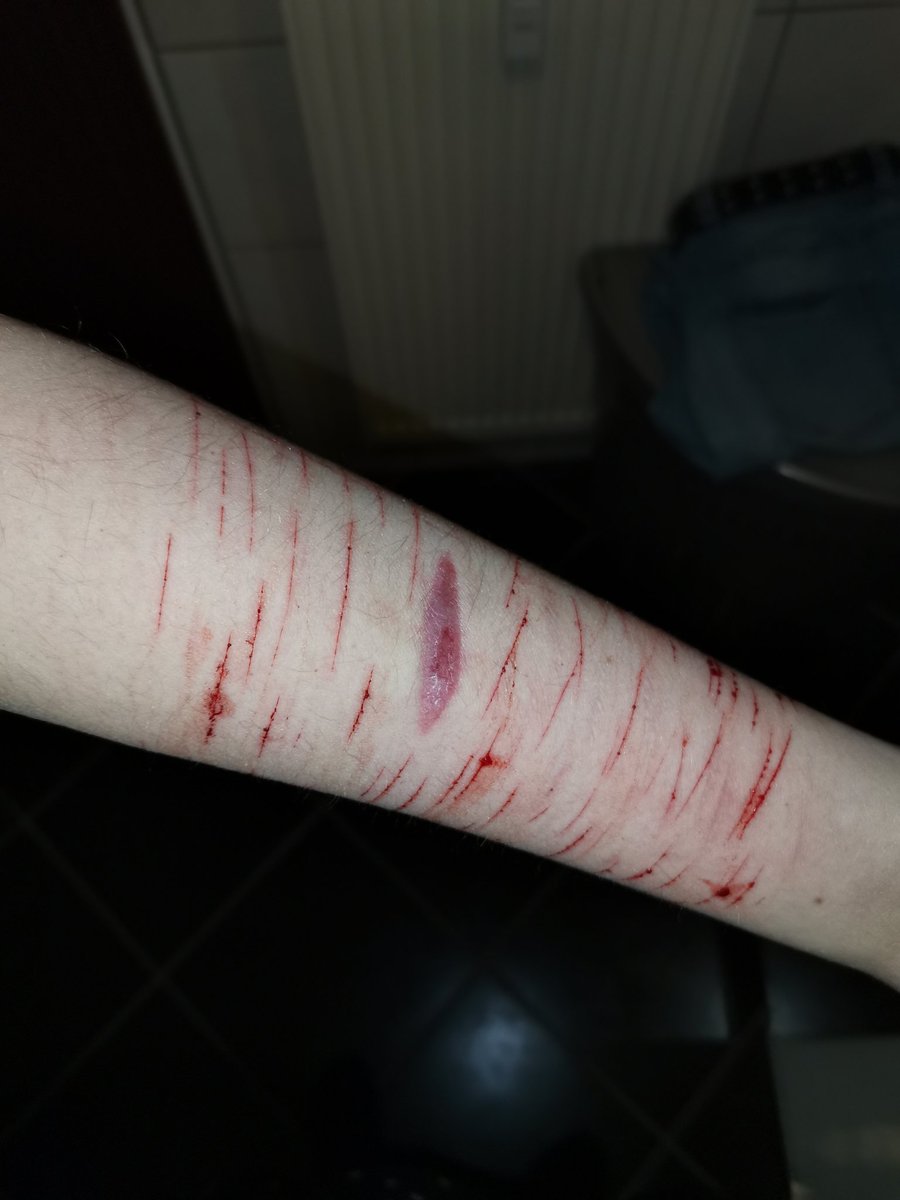 ZeraEmpero's tweet photo. Ouch ig....?
#shtwt #selfharm https://t.co/zWsL5jTZyt