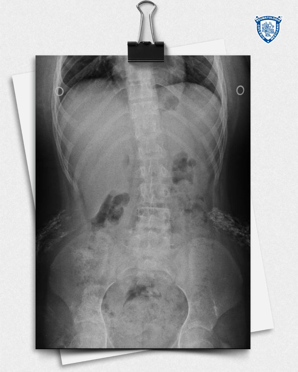 ColMexReuma tweet media