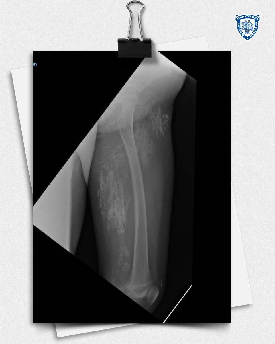 ColMexReuma tweet media