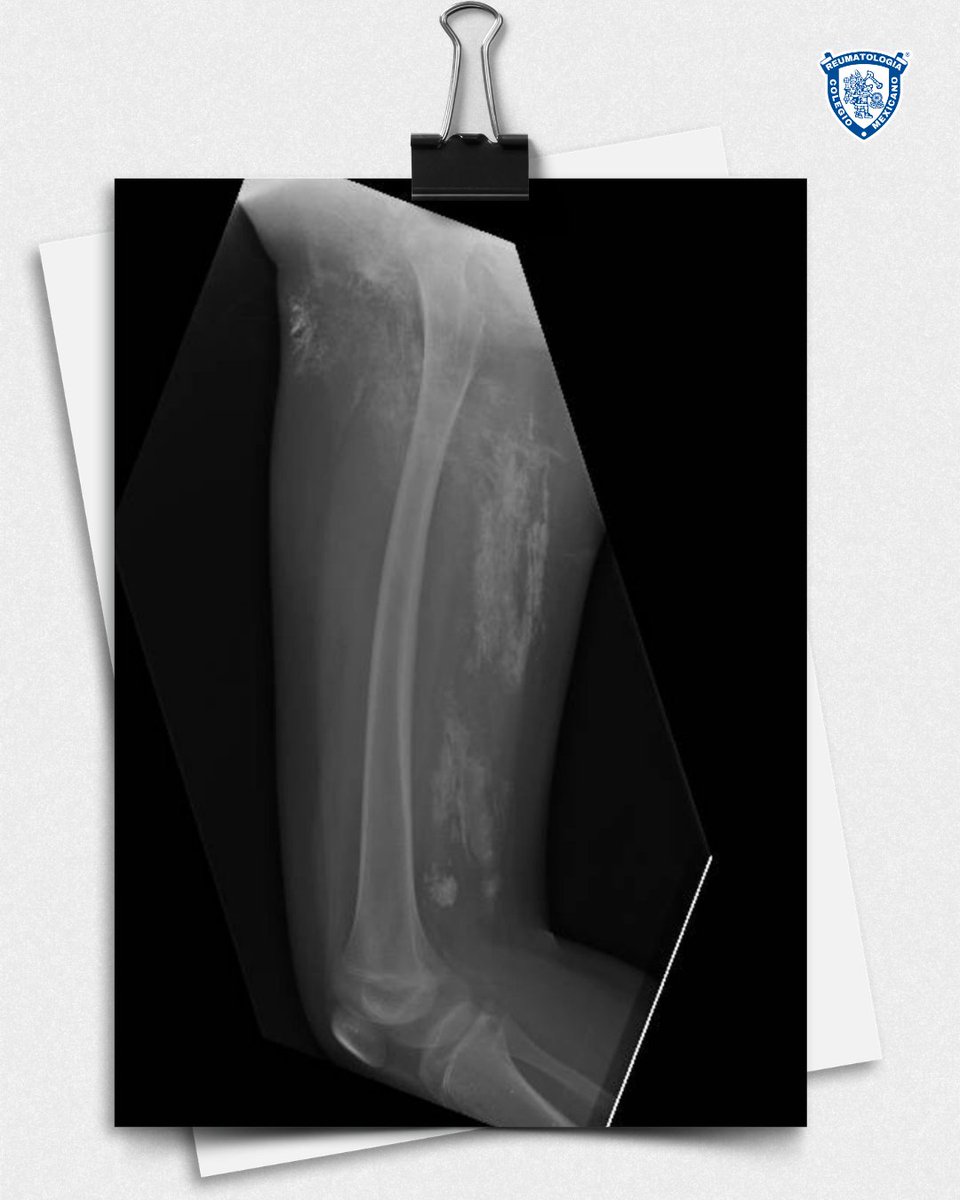 ColMexReuma tweet media