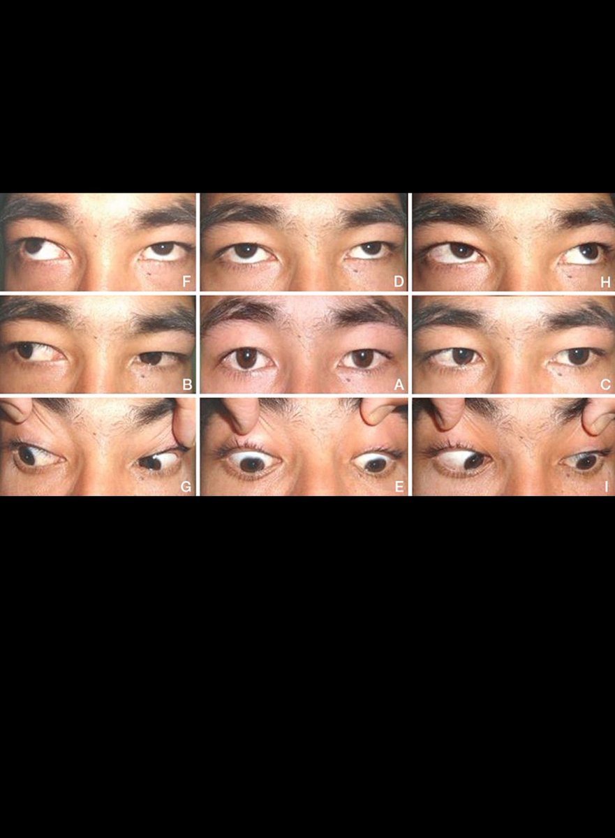 RAED ALOTAIBI tweet media