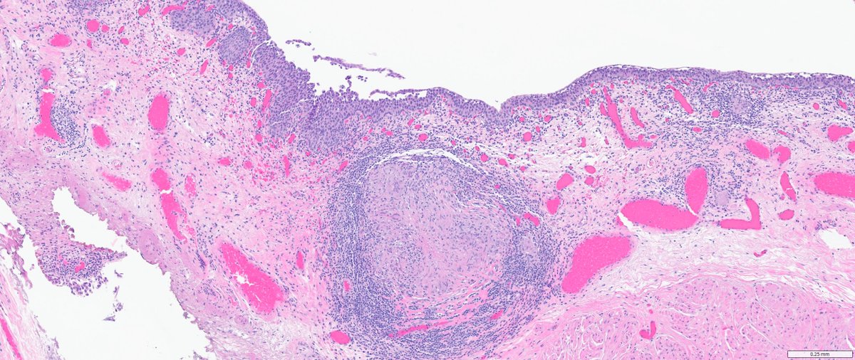 Ankur Sangoi tweet media