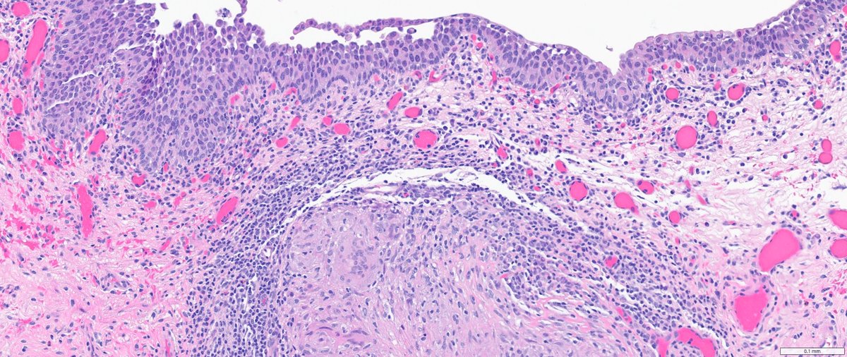 Ankur Sangoi tweet media