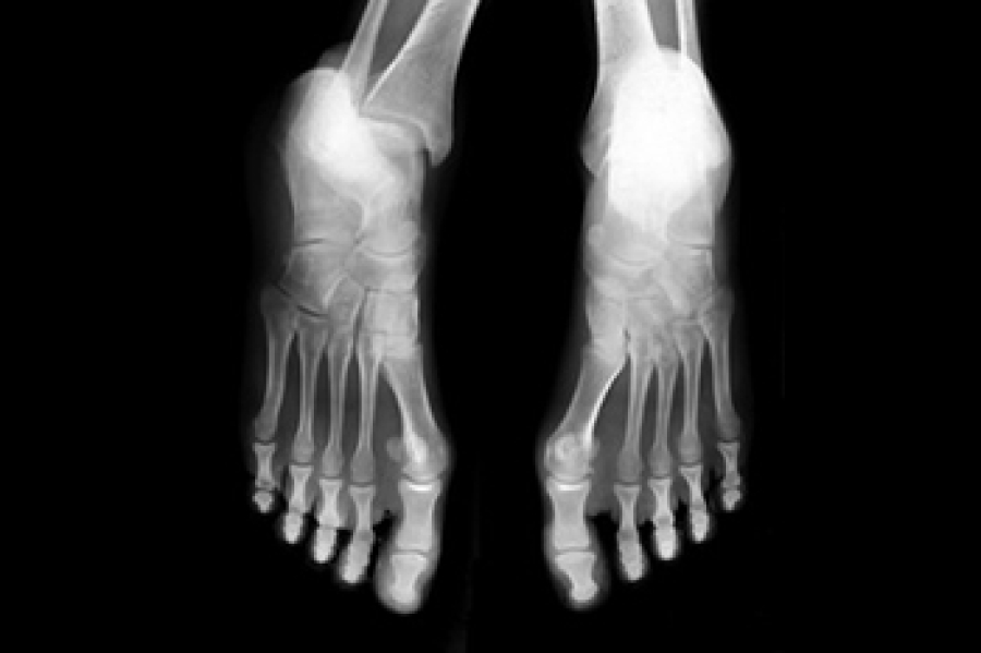 What Is Supination and Pronation? dlvr.it/TRQ8pP