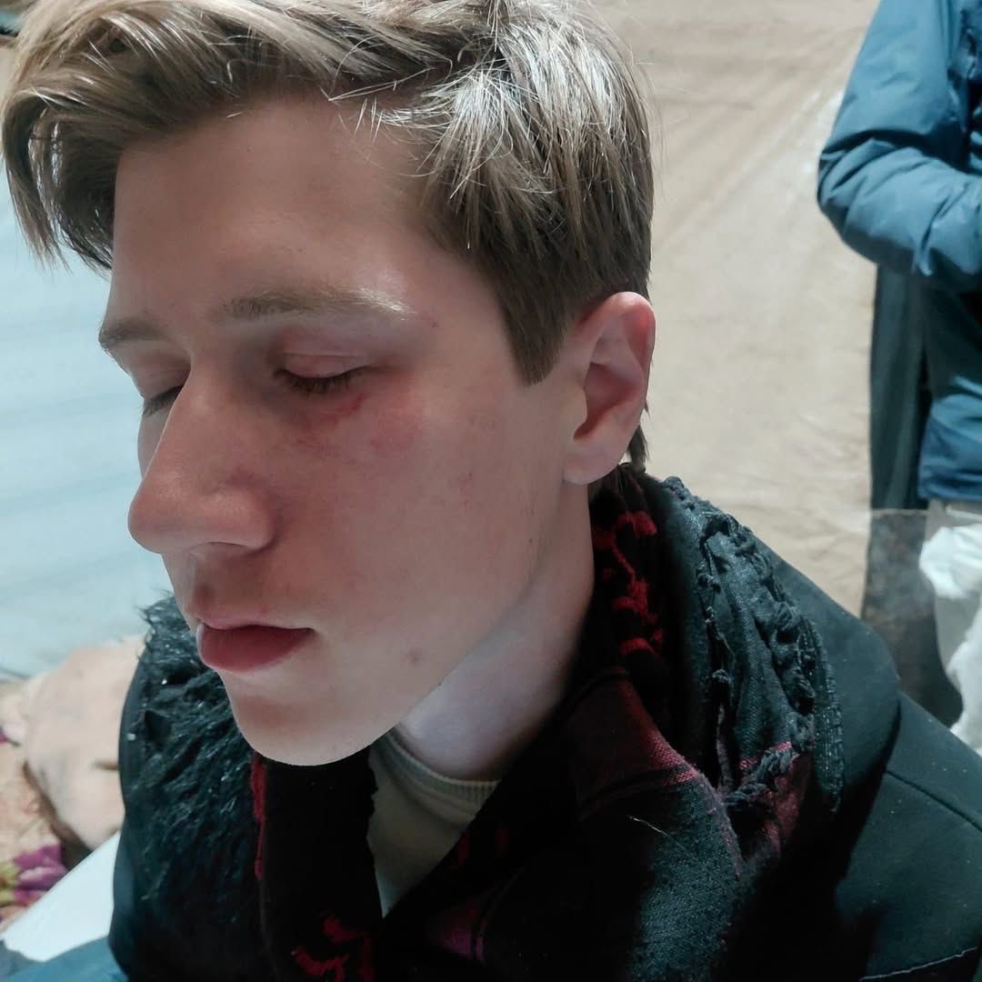 A 70-year-old Palestinian man was assaulted by Israeli settlers in the Jordan Valley and was taken to the hospital, where his condition was reported as stable.

Two activists were also injured during the attack. One of them was repeatedly kicked in the face and head.