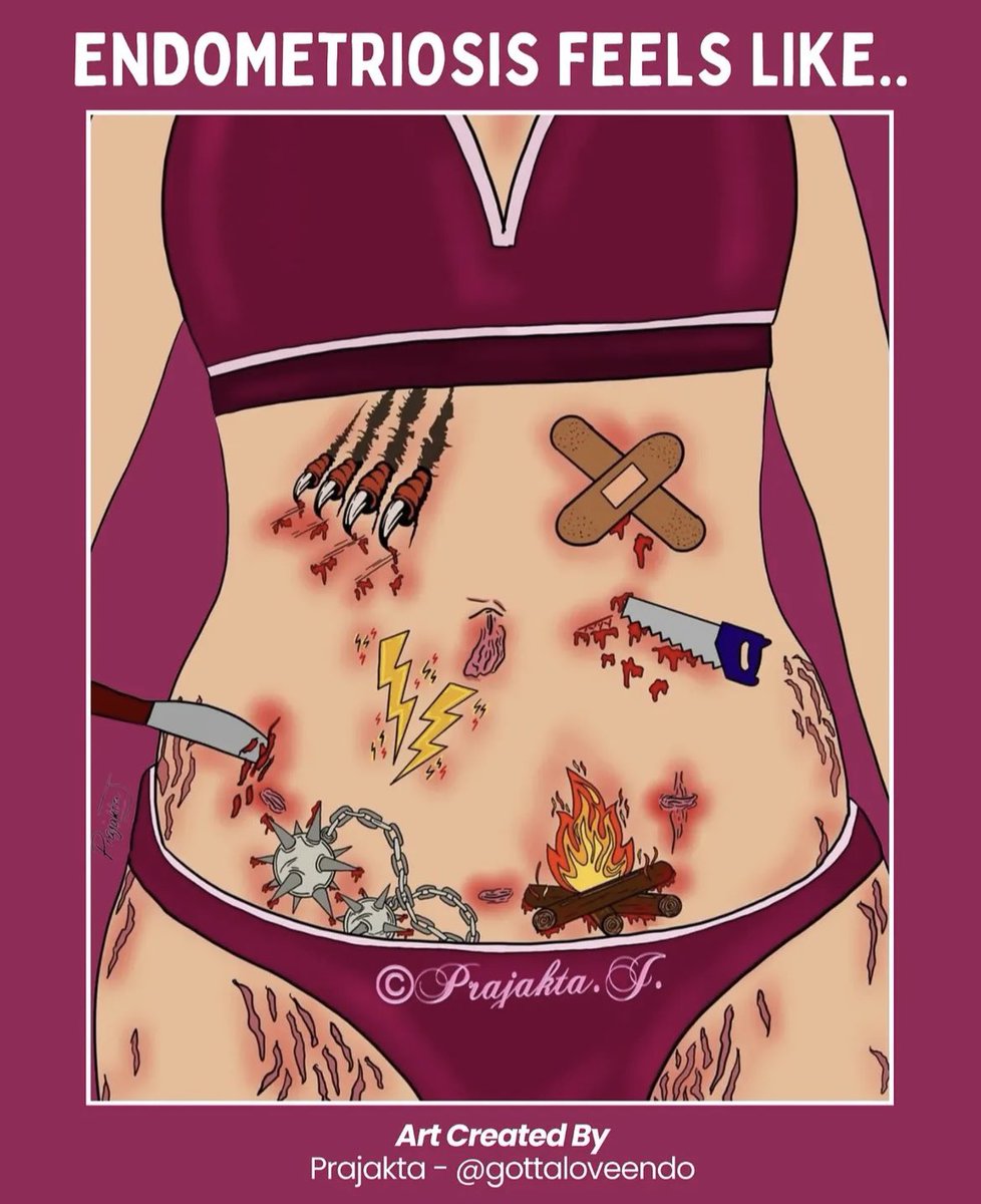 CWengaard's tweet image. March is Endometriosis Awareness Month,&amp;amp; I know too well what it’s like living with Endo.I have been through hell.Being mistreated &amp;amp; gaslit in the health care system.

My heart goes out to EVERYONE in the same situation♥️🙏

#Endometriosis #chronicillness #pain #fatigue